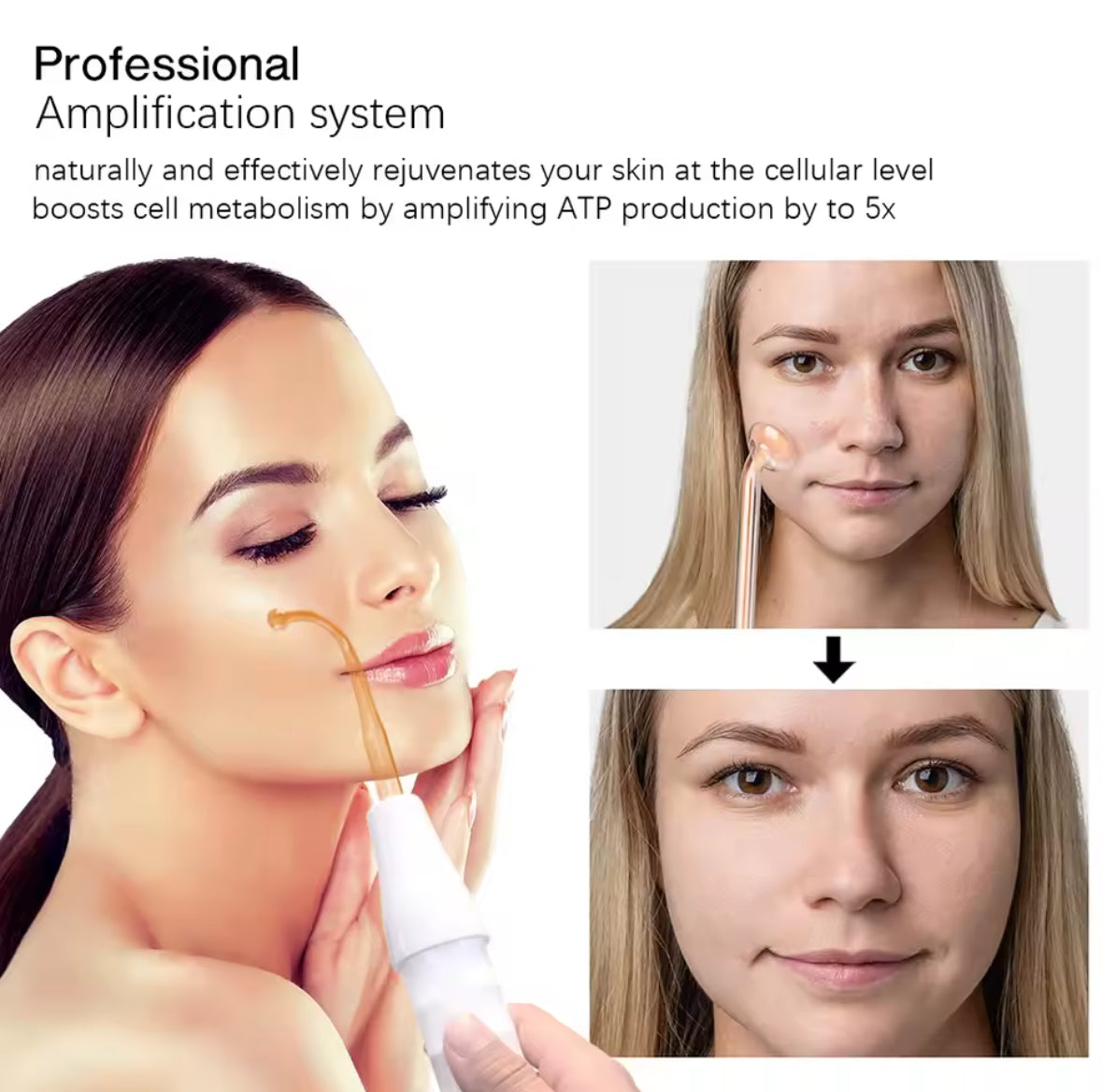 High Frequency Facial Wand – Anti-Acne & Skin Tightening Device
