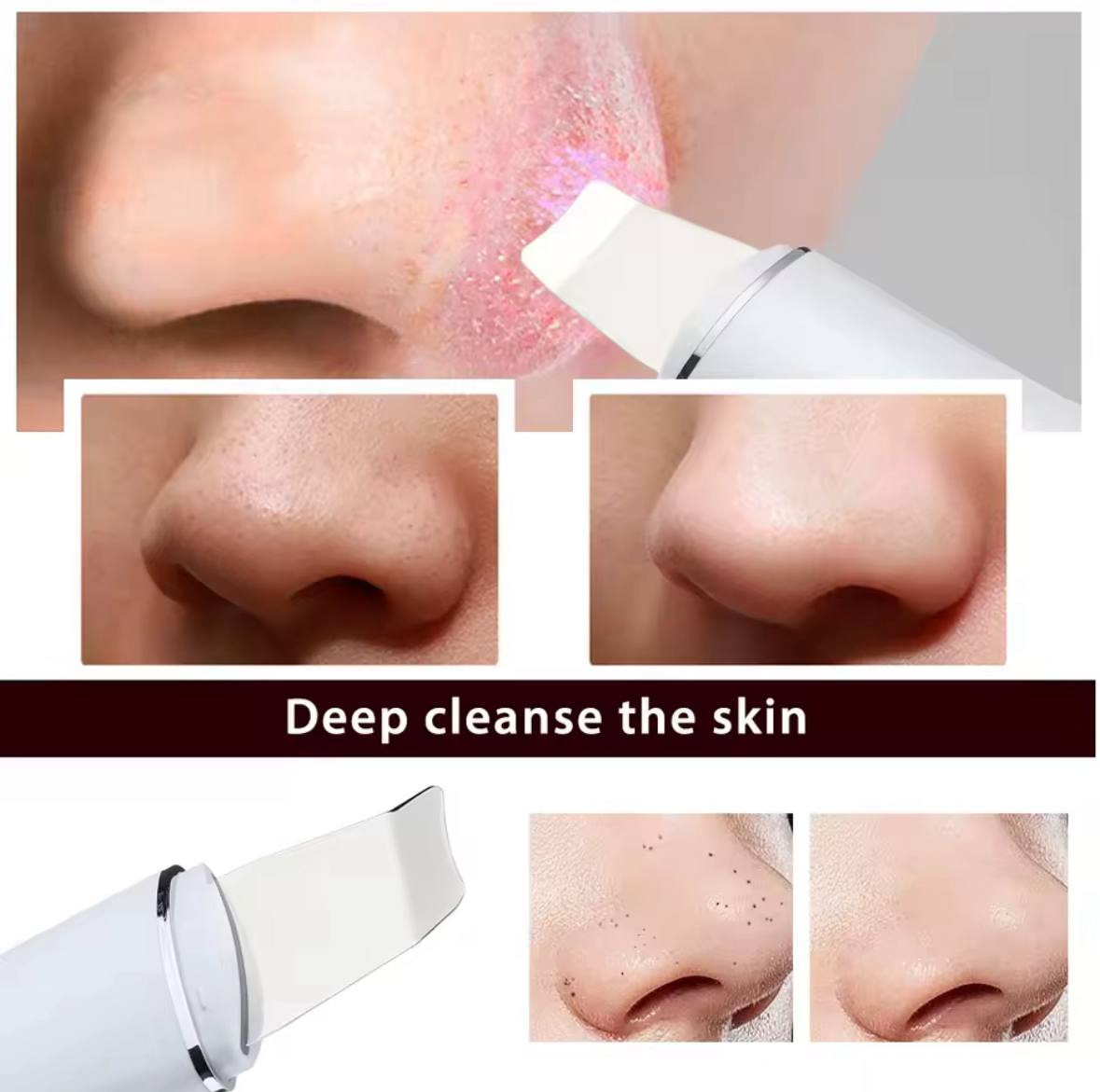 Nano Ionic Facial Steamer – Deep Hydration & Pore Cleaner